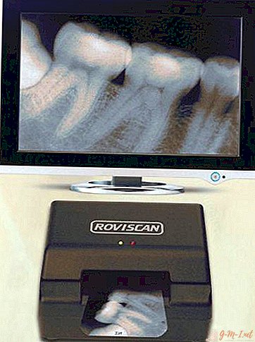 Comment numériser une radiographie sur un scanner conventionnel