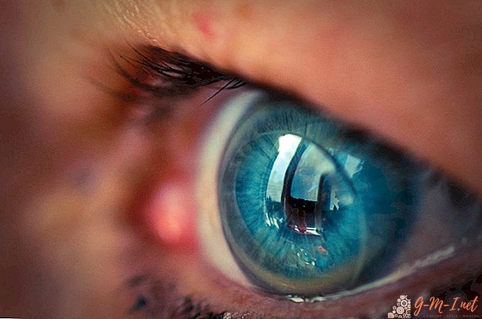 Kako odabrati kontaktne leće