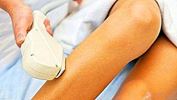 Pros and cons of photoepilator